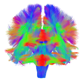 Figure from Deeptract: A probabilistic deep learning framework for white matter fiber tractography‏